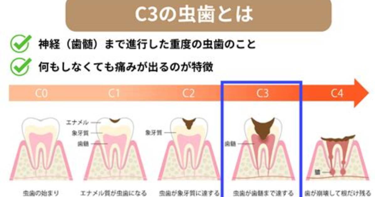 What Does C3 Condition Mean