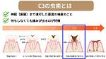 What Does C3 Condition Mean