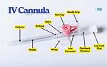 What Does Cannula Mean?
