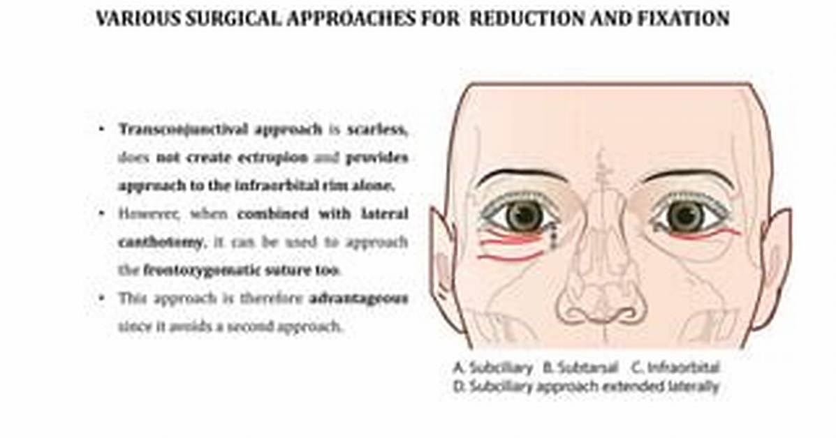 What Does Canthotomy Mean