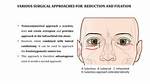 What Does Canthotomy Mean