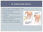 What Does Cap Refill Assess
