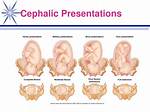 What Does Cephalic Long Mean?