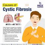 What Does Cf Mean