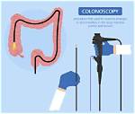 What Does Colonoscopy Mean?