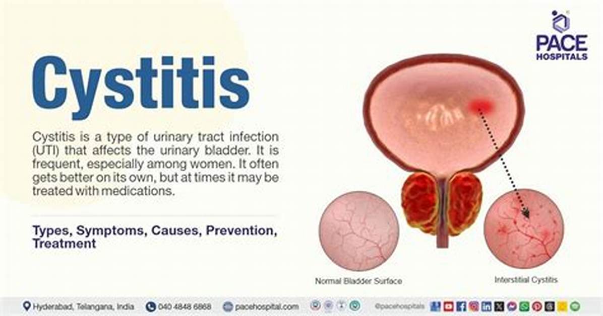 What Does Cystitis Mean?