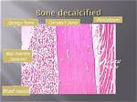 What Does Decalcified Bone?