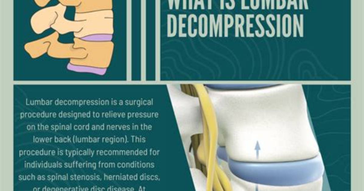 What Does Decompress Mean