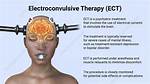 What Does Ect Stand For
