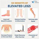 What Does Elevating Your Legs Do?