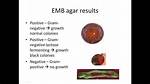 What Does Emb Test for?