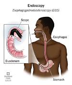 What Does Endoscopy Mean?