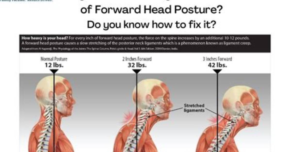 What Does Forwardness Me?