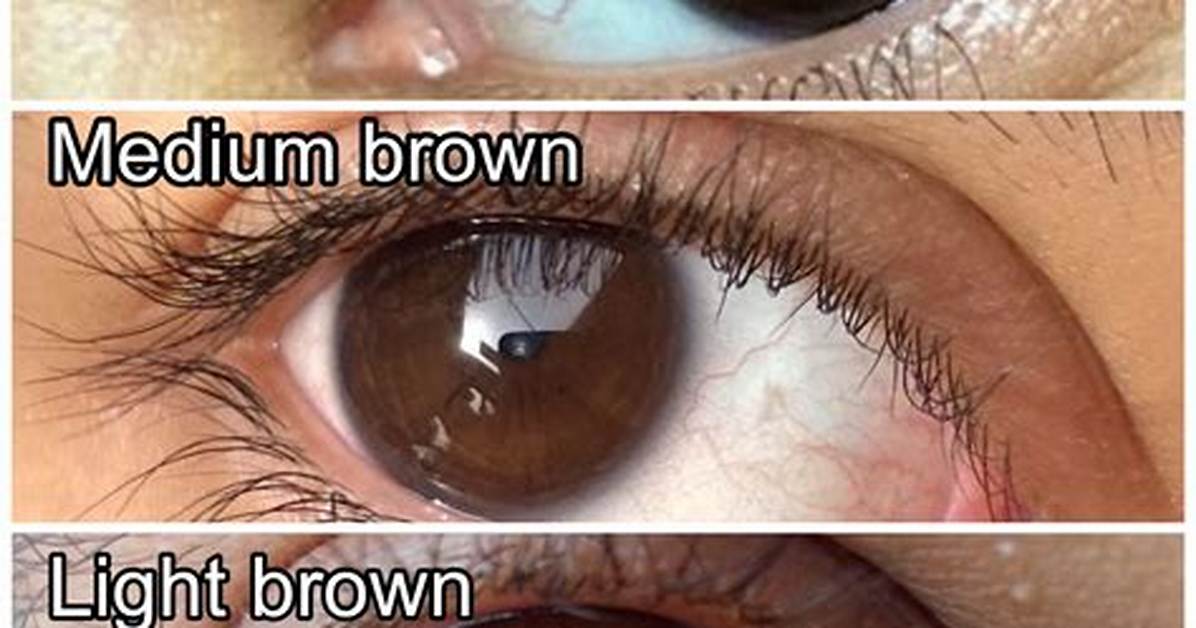 What Does Having Dark Features Mean?