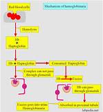What Does Hemoglobinuria Indicate?
