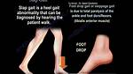 What Does High Stepping Do?