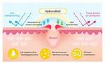 What Does Hydrocolloid Do?
