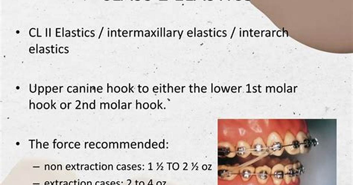 What Does Intermaxillary Mean?