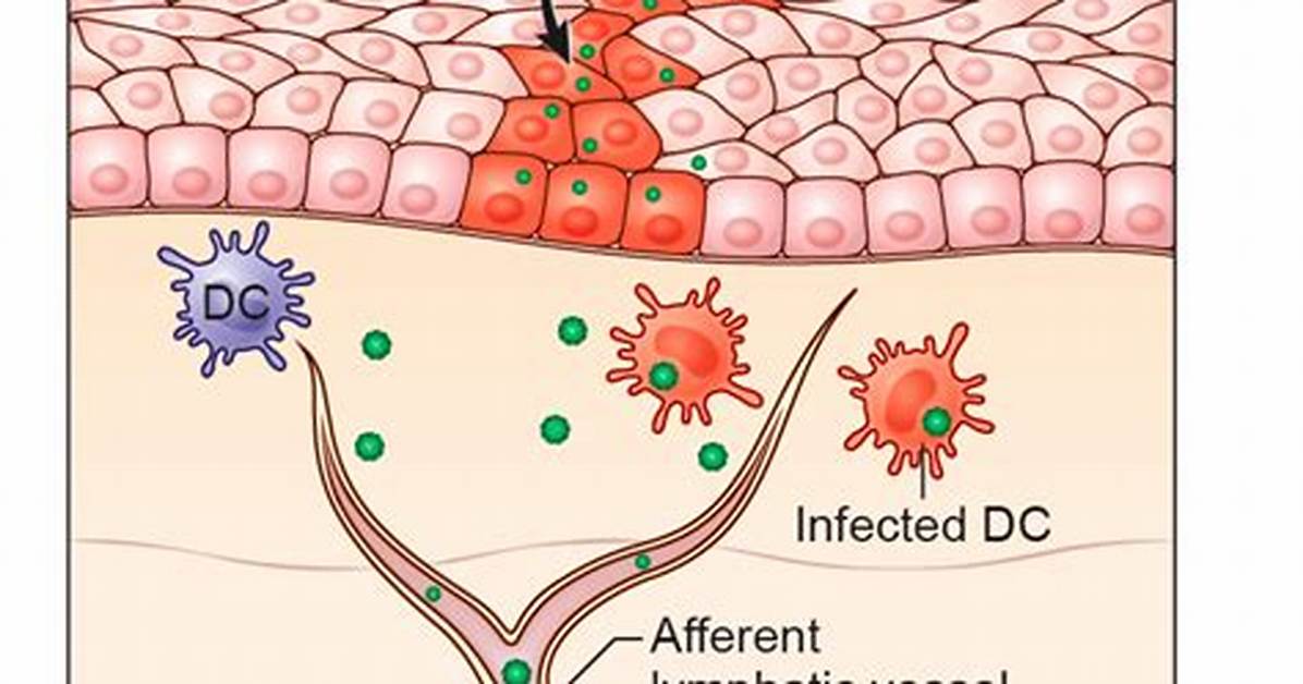 What Does Lymphogenous Mean?