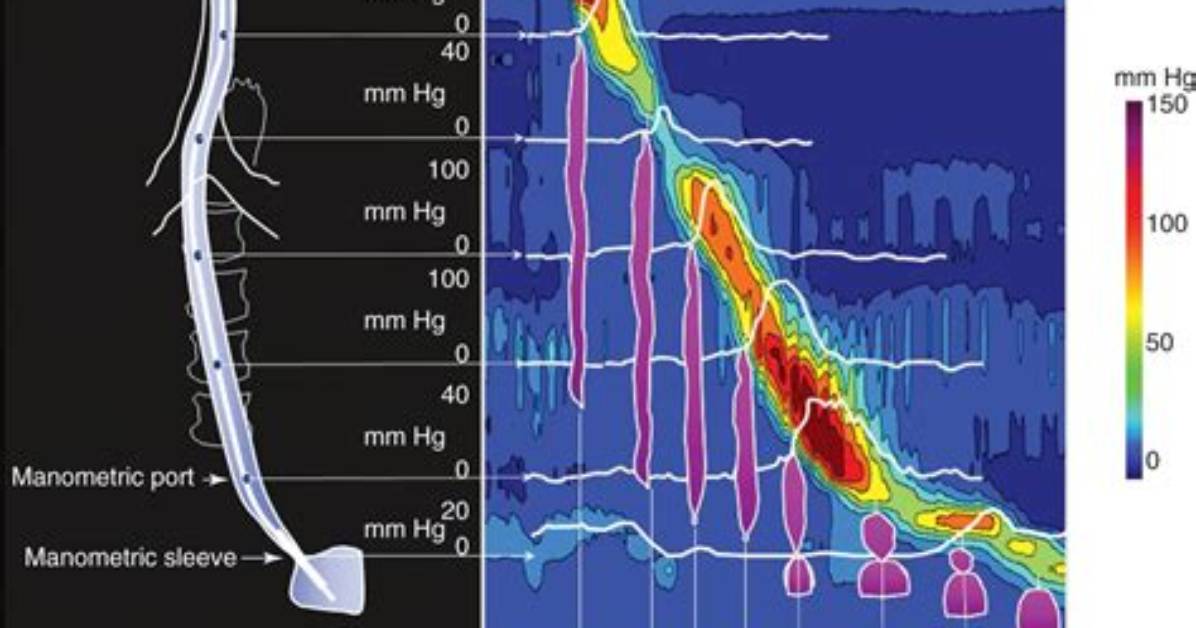 What Does Manometry Show?