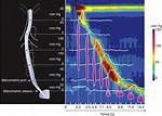 What Does Manometry Show?