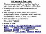 What Does Microphthalmic Mean?