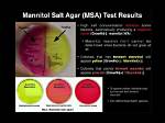 What Does Msa Test For