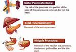 What Does Necrosectomy Mean?