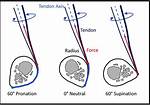 What Does Nonanatomic Mean?
