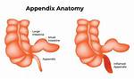 What Does Nonvisualized Appendix Mean?
