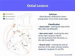 What Does Ostial Mean?
