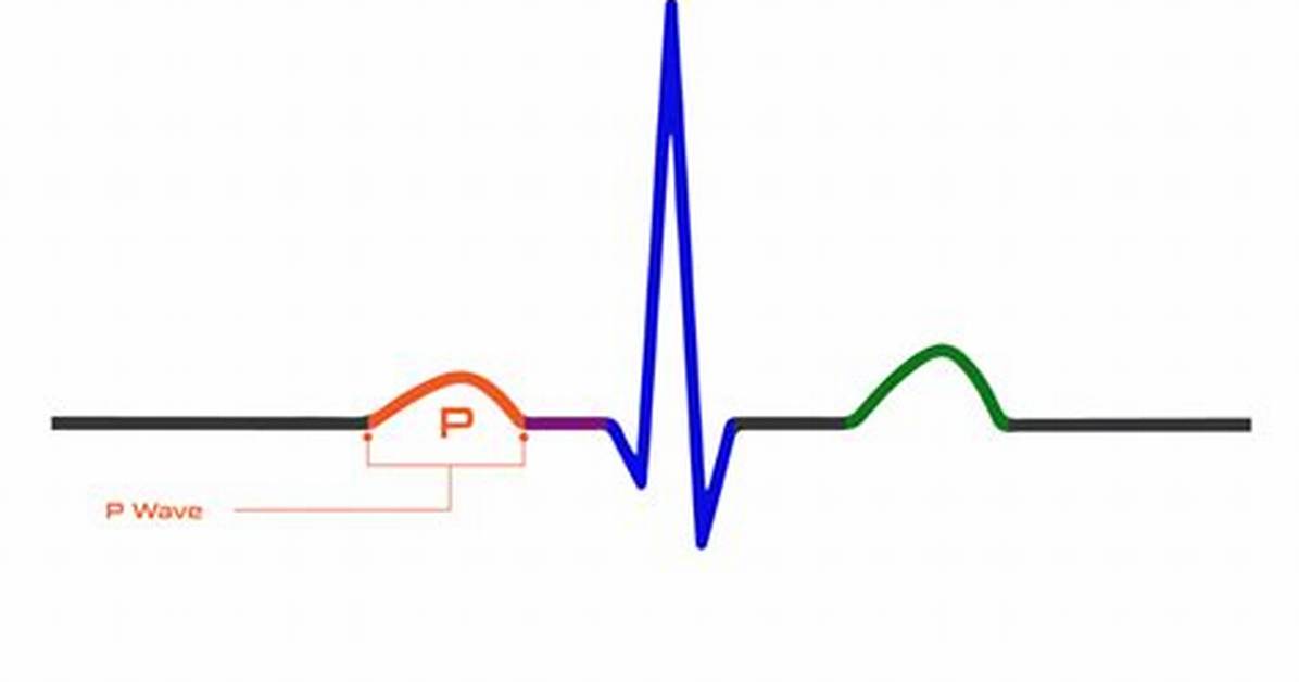 What Does P Wave Represent