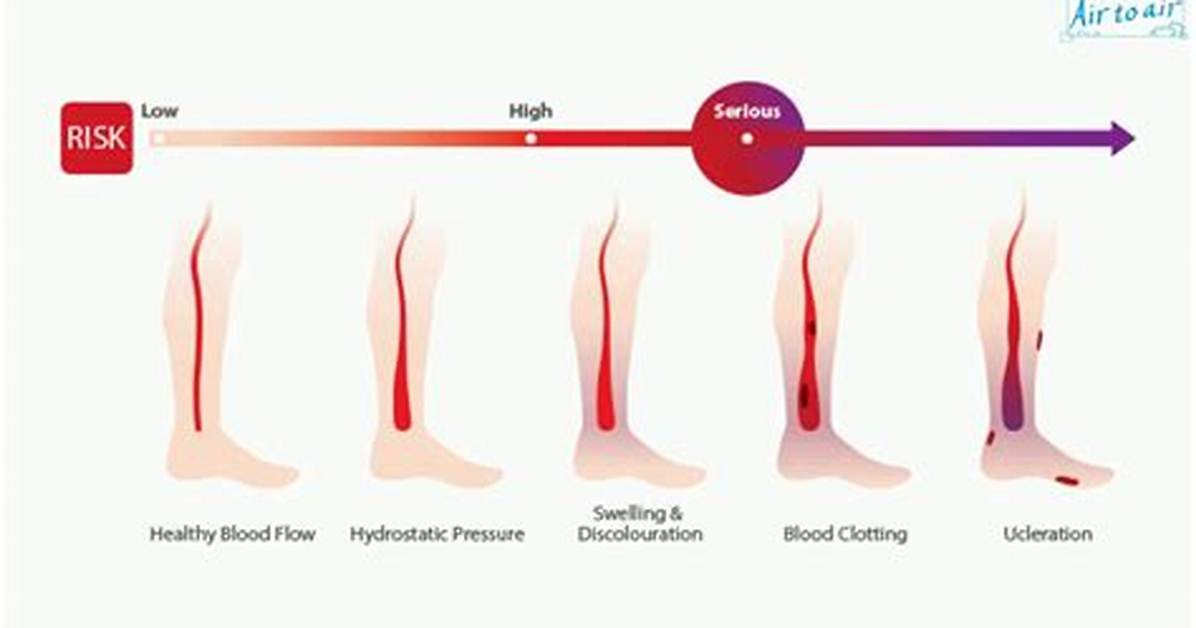 What Does Phlebostasis Do?