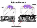 What Does Placenta Diffuse Mean