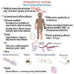 What Does Polyarteritis Mean?