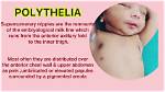 What Does Polythelia Mean?