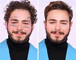 What Does Post Malone Look Like Without Face Tattoos?
