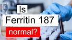 What Does Pr 187 Mean?