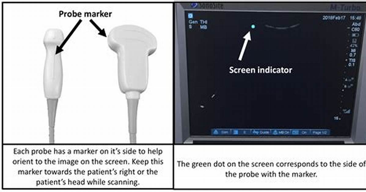 What Does Probe Mean