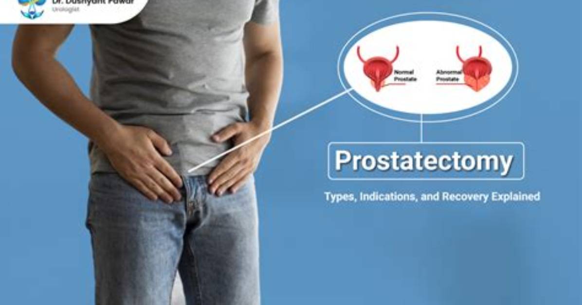 What Does Prostatectomy Mean?