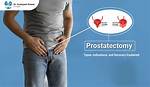 What Does Prostatectomy Mean?