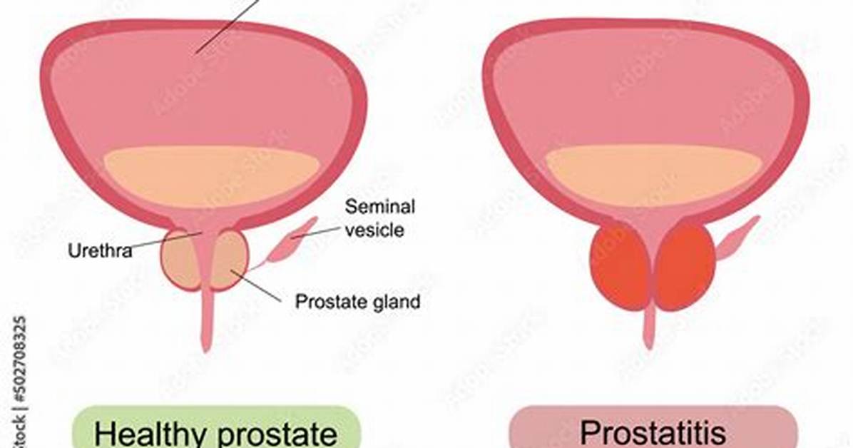 What Does Prostrate Mean