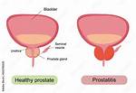 What Does Prostrate Mean