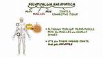 What Does Rheumatica Mean