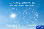 What Does Seeing Flashes Mean?