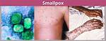What Does Smallpox Look Like