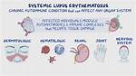 What Does Systemic Cause Mean?