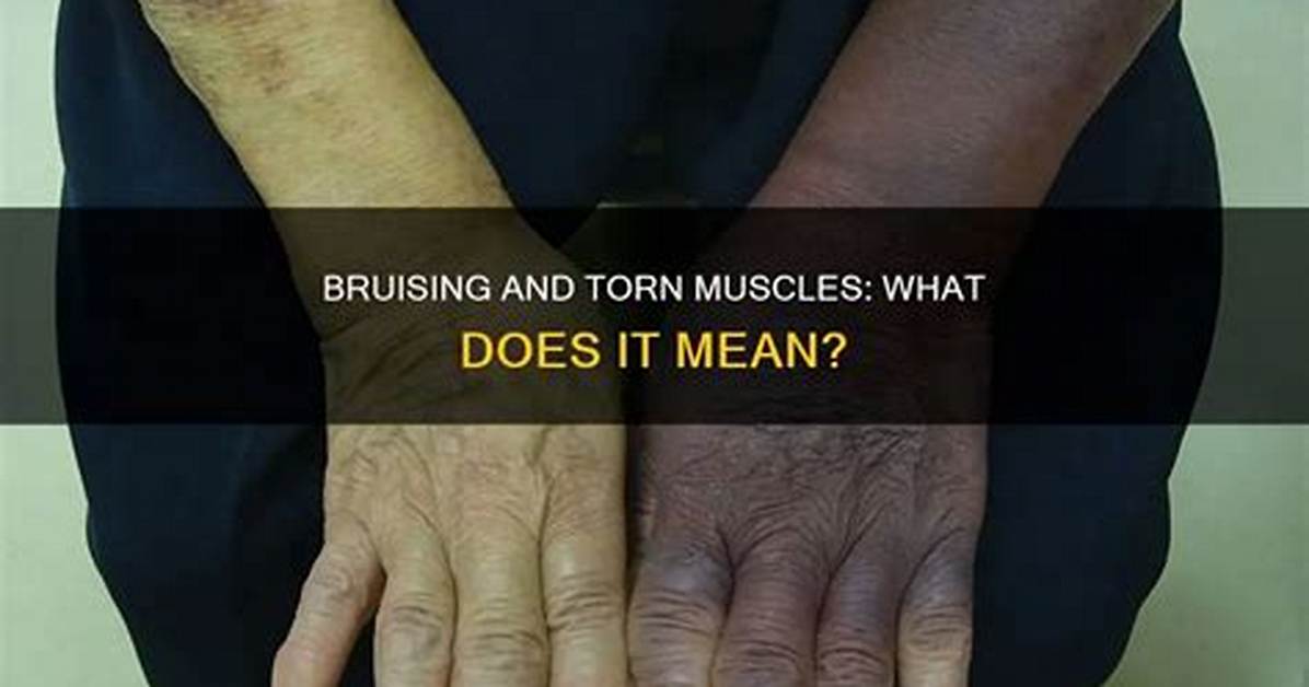 What Does Torn Mean?