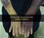 What Does Torn Mean?