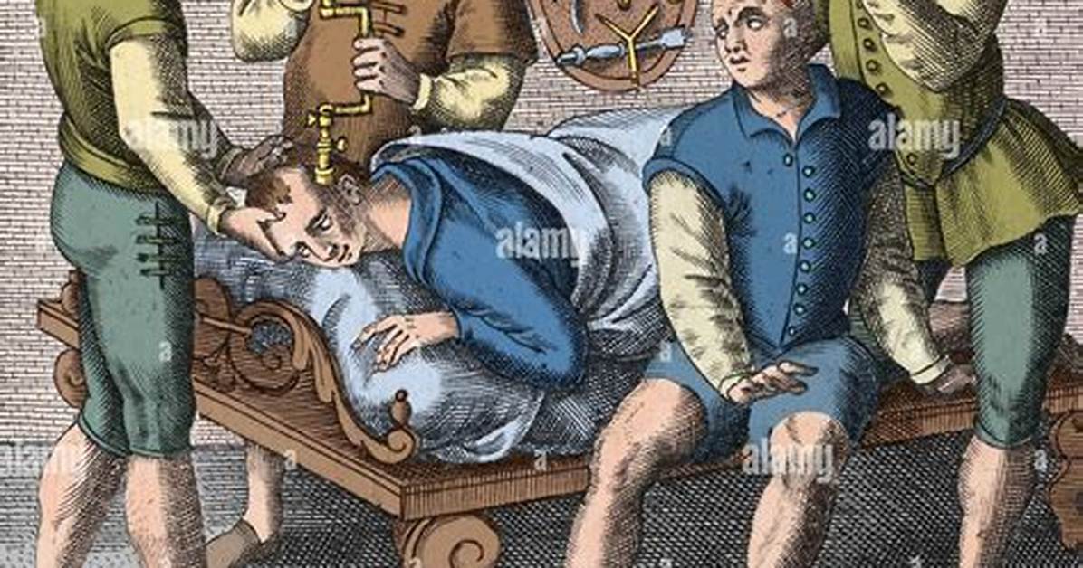 What Does Trepanning Do?